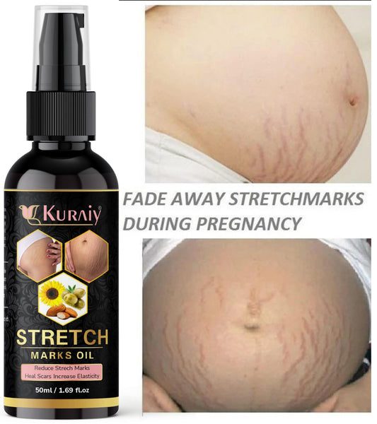 Kuraiy present Repair Stretch Marks Removal - Natural Heal Pregnancy Breast, Hip, Legs, Mark oil 500 ml pack of 1